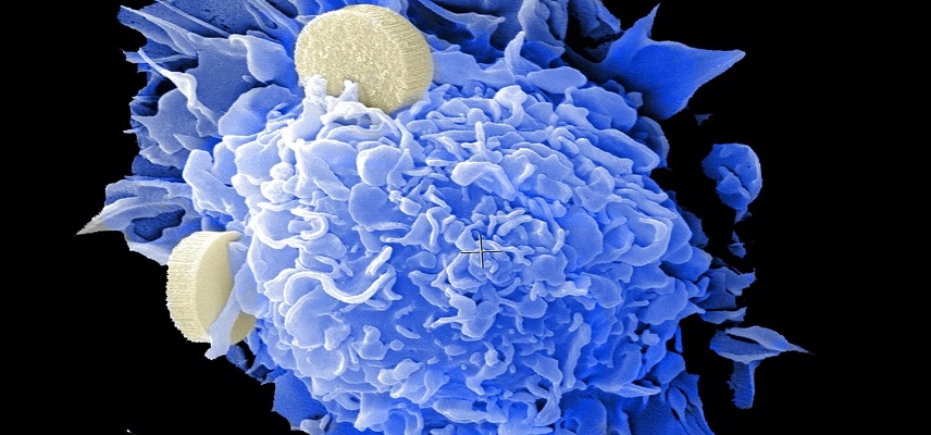 Enlivex Announces Positive Results from Phase II Trial of Allocetra